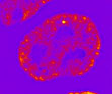 /media/plugins/trackmate/detectors/trackmate-hessian-detector-08.png