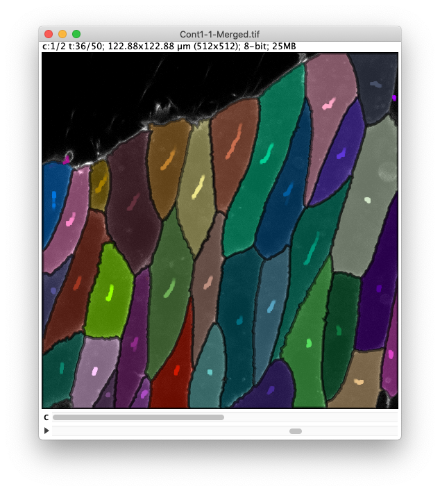 /media/plugins/trackmate/trackmate-morpholibj-tutorial-14.png