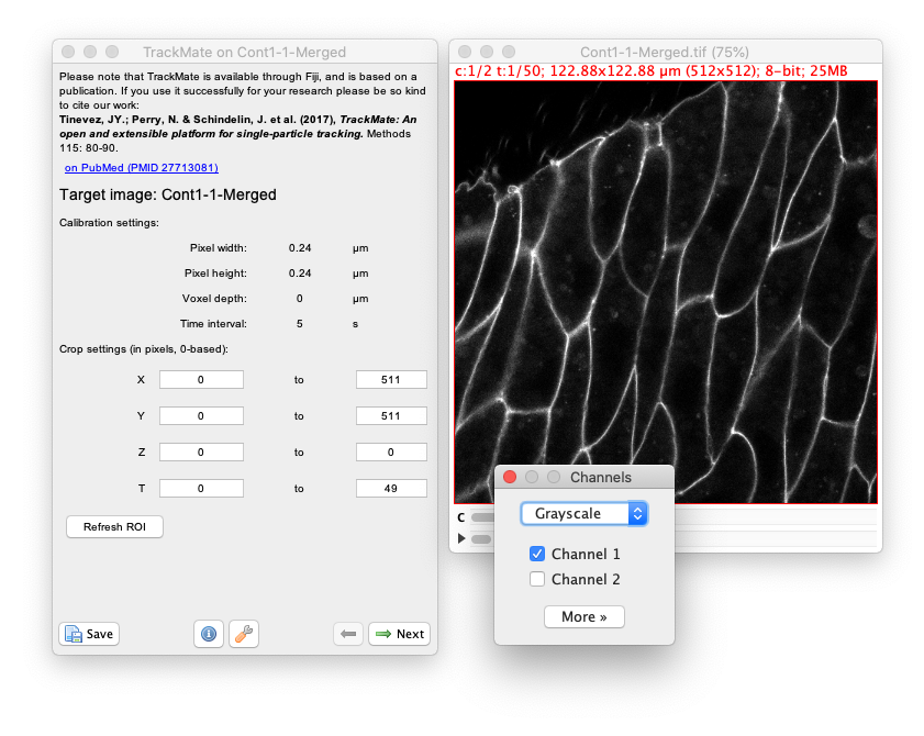 /media/plugins/trackmate/trackmate-morpholibj-tutorial-2.png