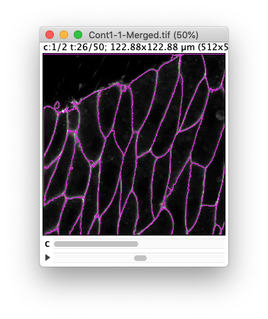 /media/plugins/trackmate/trackmate-morpholibj-tutorial-4.png