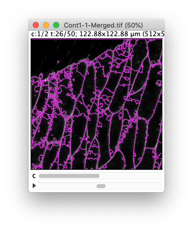 /media/plugins/trackmate/trackmate-morpholibj-tutorial-5.png