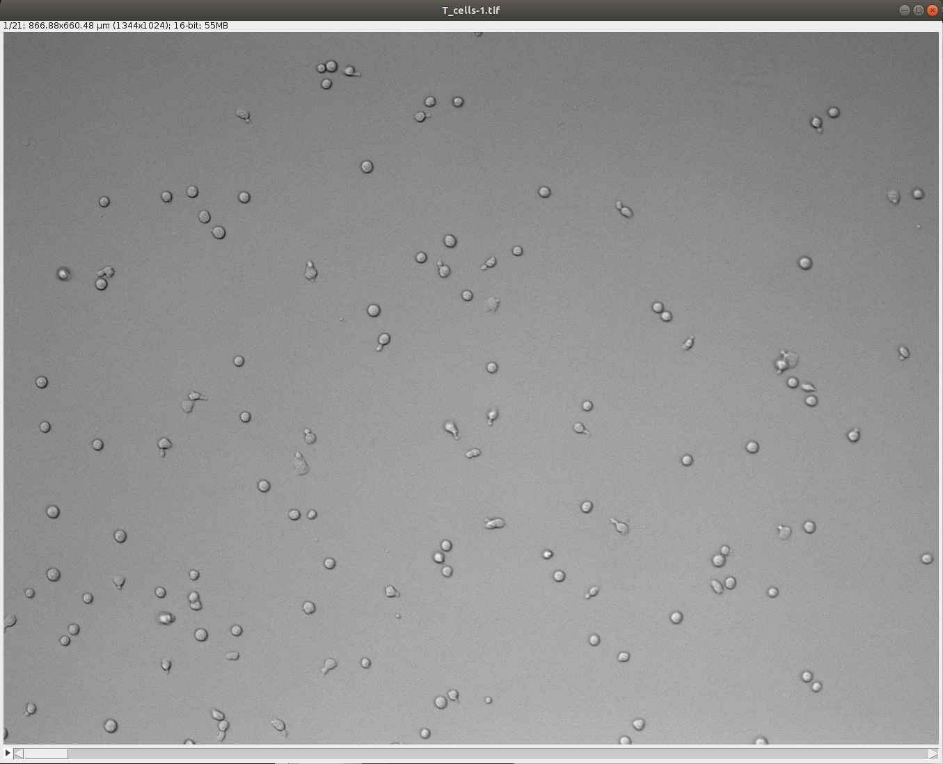 /media/plugins/trackmate/trackmate-stardist-custom-detector-2-image.png