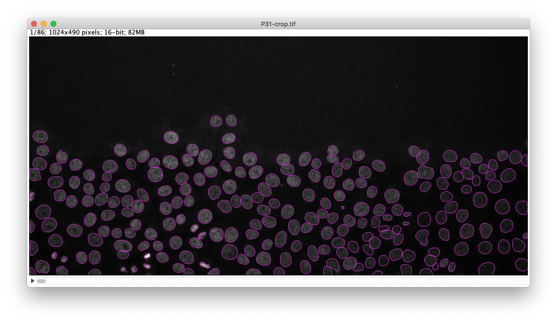 /media/plugins/trackmate/trackmate-stardist-preview-results.png