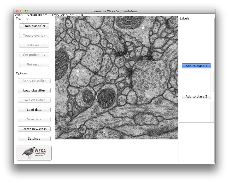 Example of the first look of the plugin window when using it on a TEM image