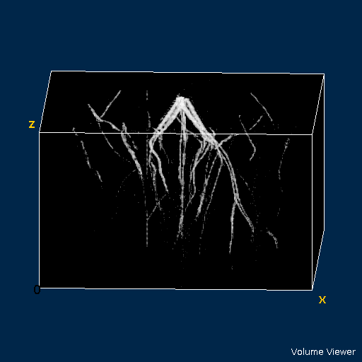 Figure 1. 3D view of mouse hindlimb vasculature.