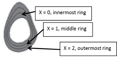Radial
