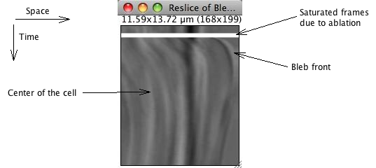 A kymograph