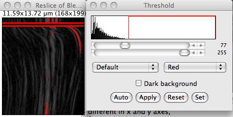 Generate and exploit kymographs 5