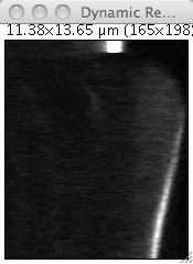 A kymograph for fluorescence image